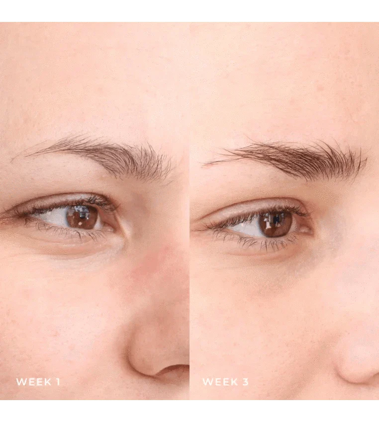 brow growth