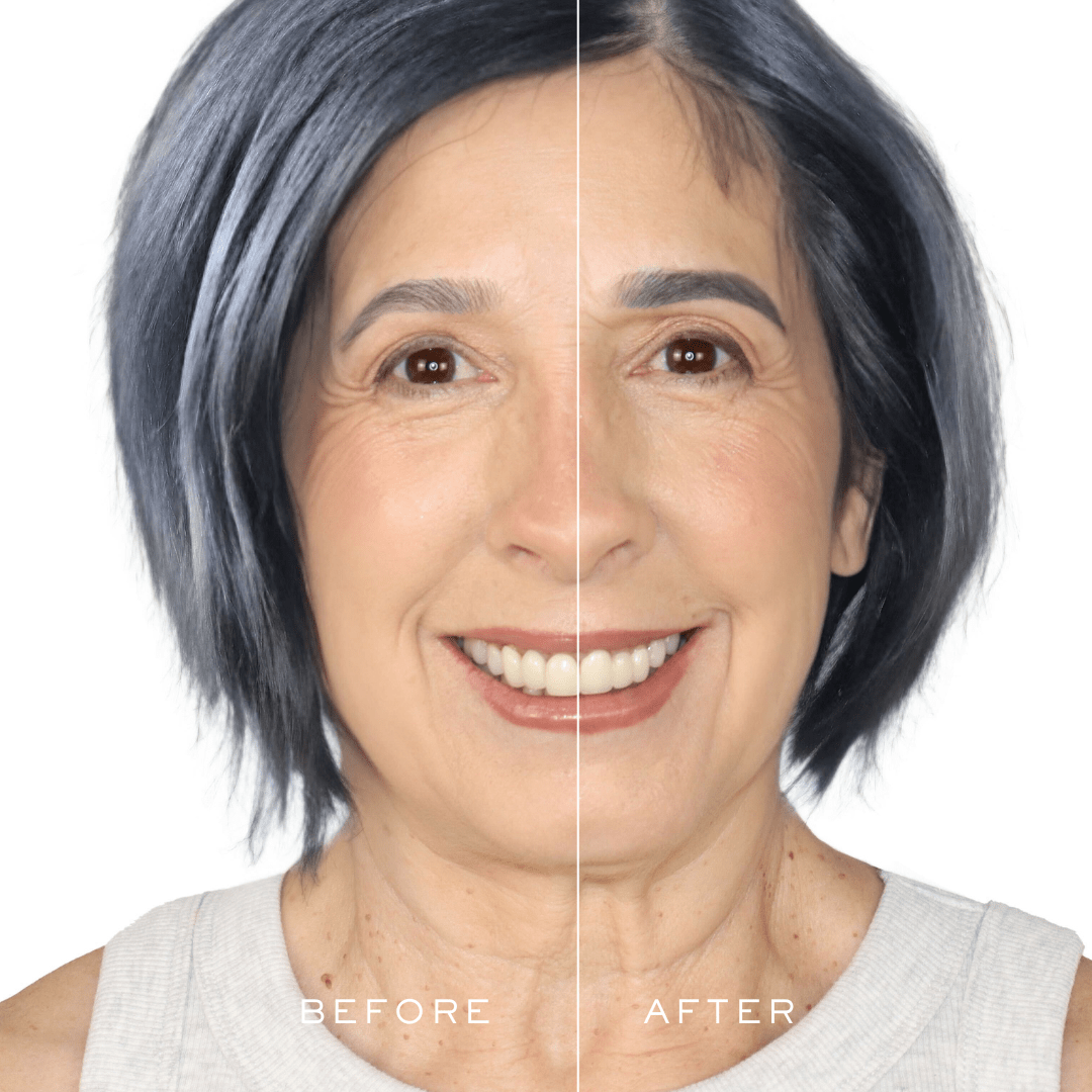 dark grey before and after